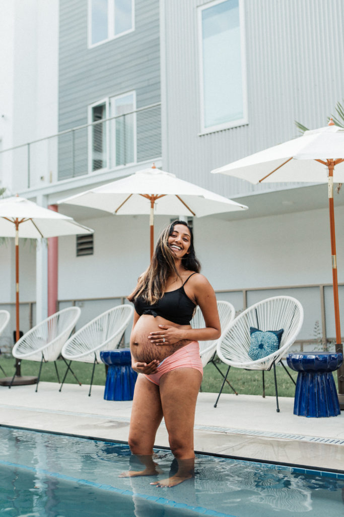 Stretch Marks on Indian Women