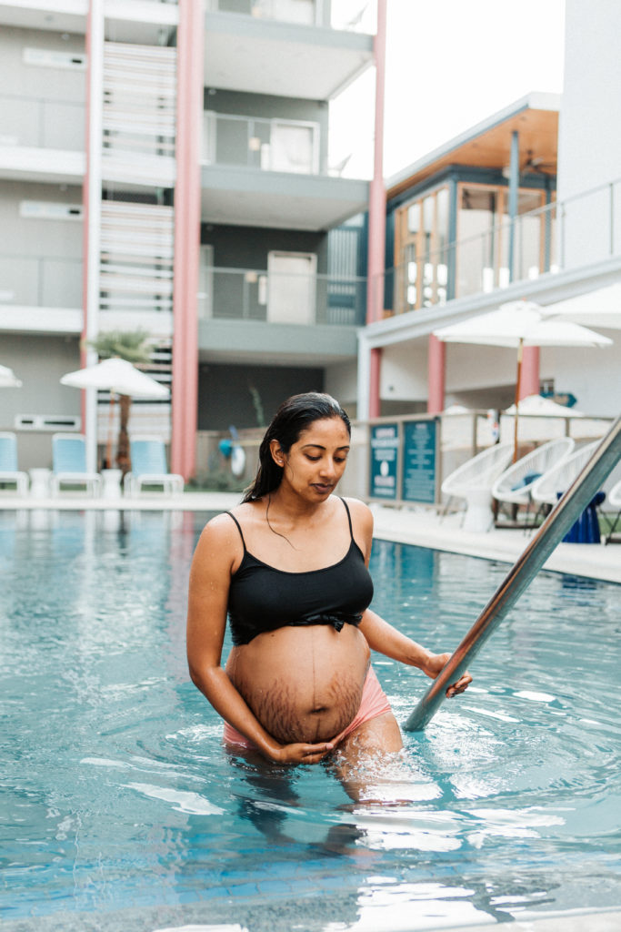 Stretch Marks on Indian Women